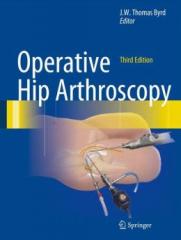 Operative Hip Arthroscopy1.jpg, 6.28 KB